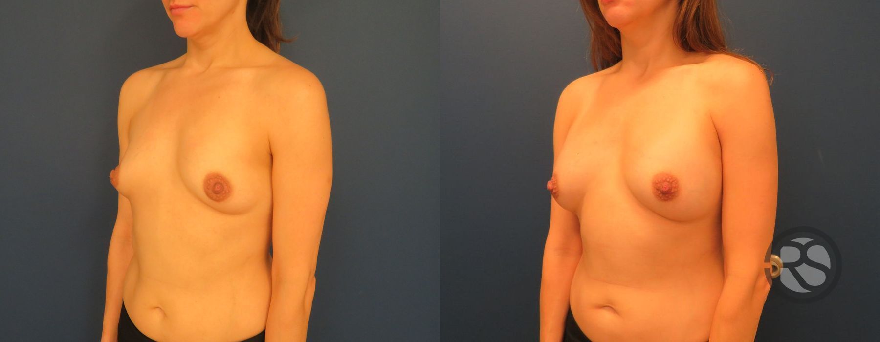 Before photo - Angle 2