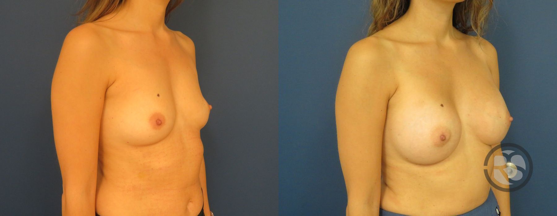 Before photo - Angle 2