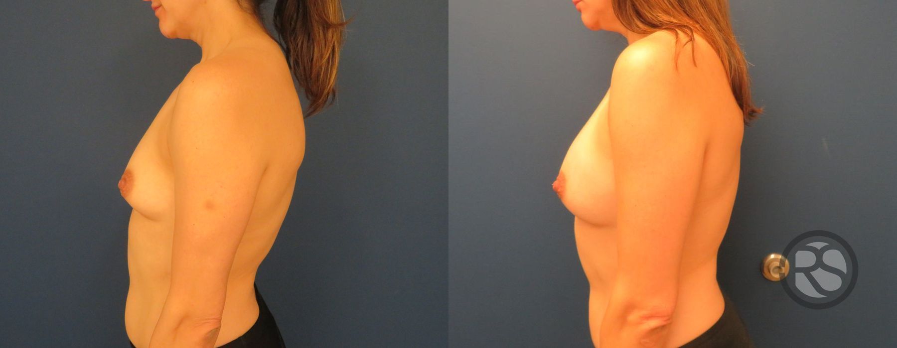 Before photo - Angle 3