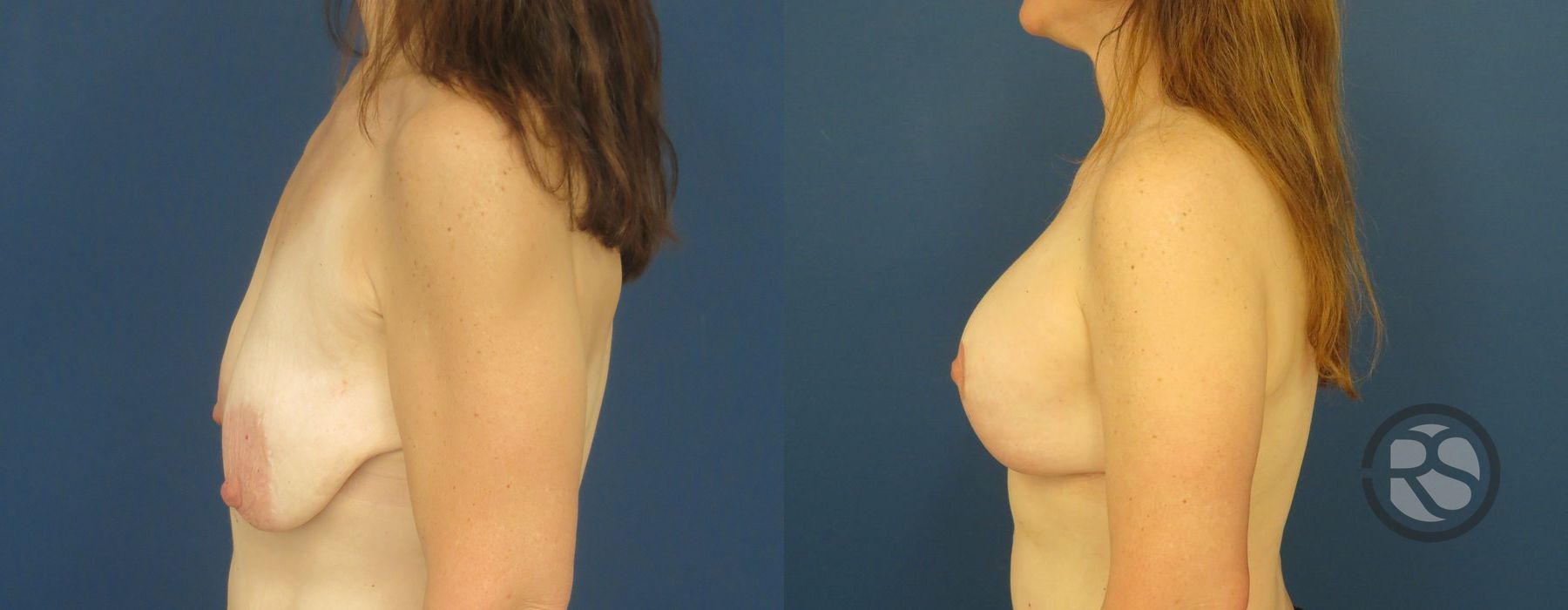 Before photo - Angle 5