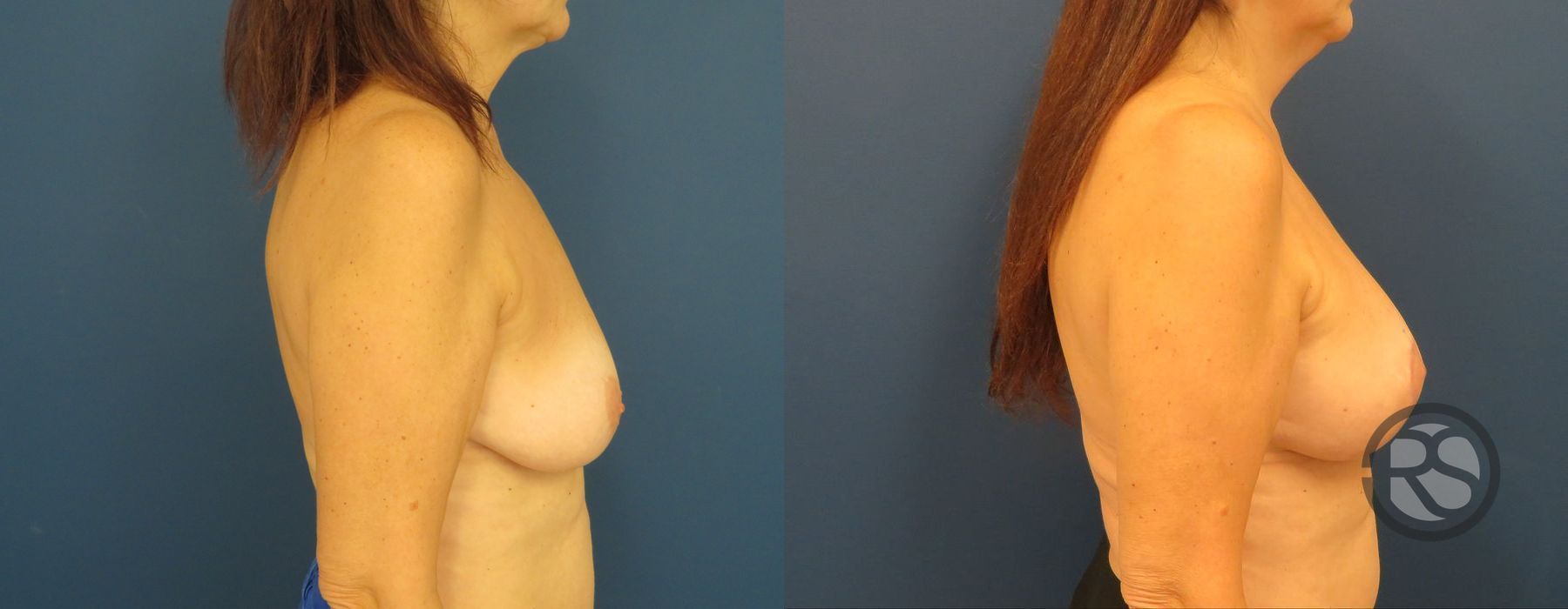 Before photo - Angle 3