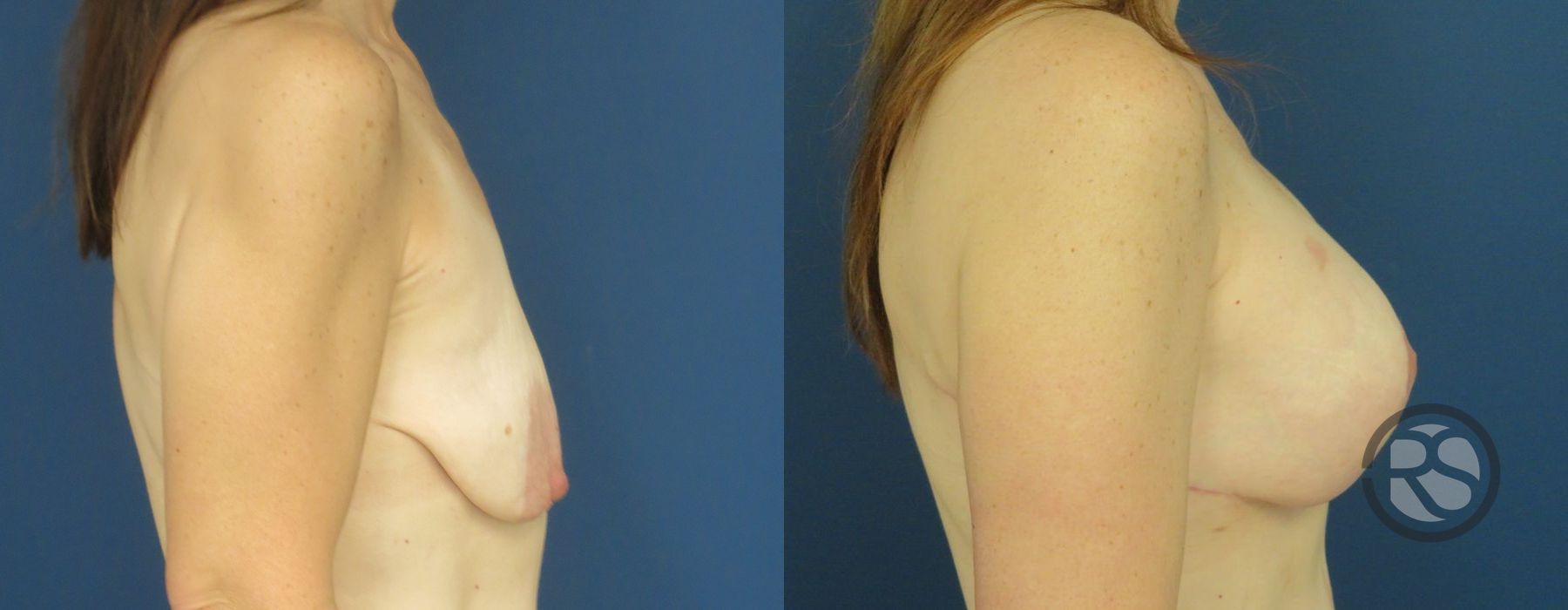 Before photo - Angle 3