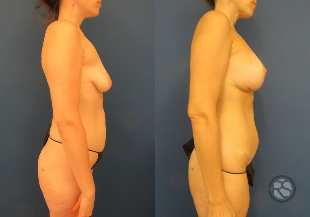 Before photo - Angle 3