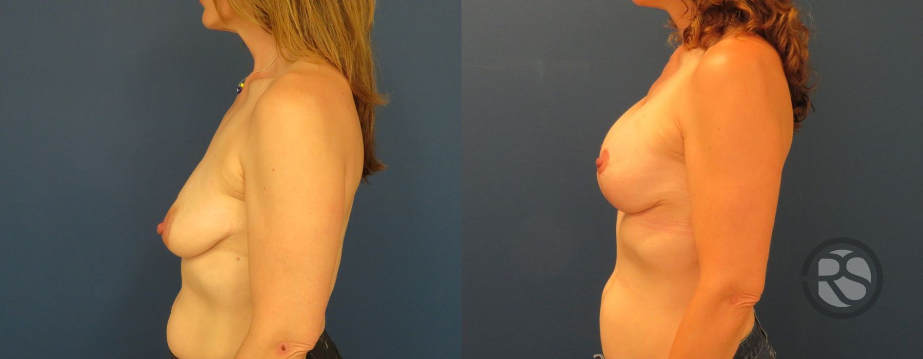 Before photo - Angle 5