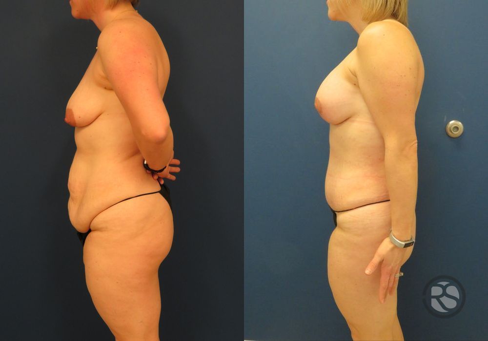 Before photo - Angle 5