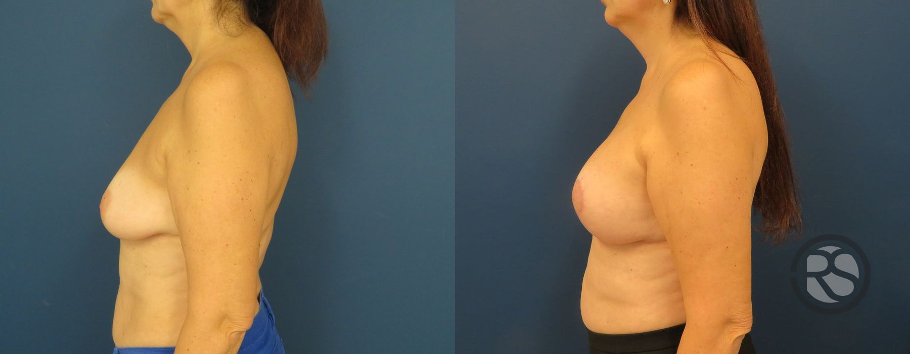 Before photo - Angle 5