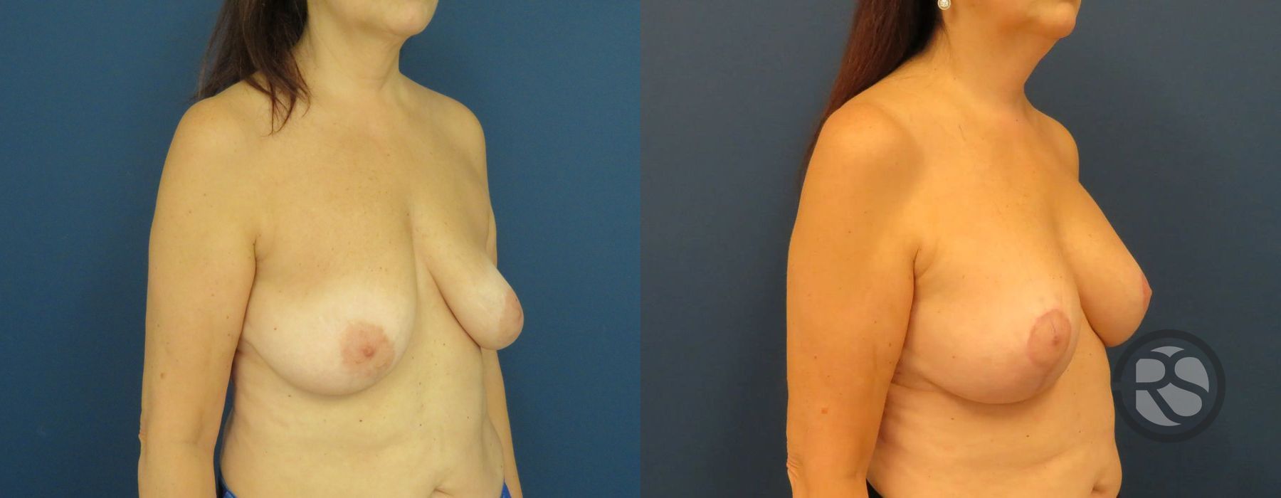 Before photo - Angle 2