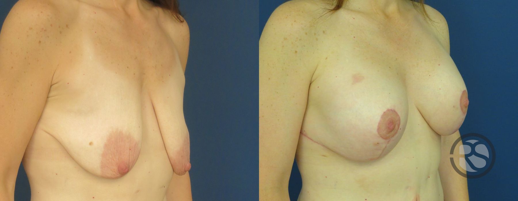 Before photo - Angle 2