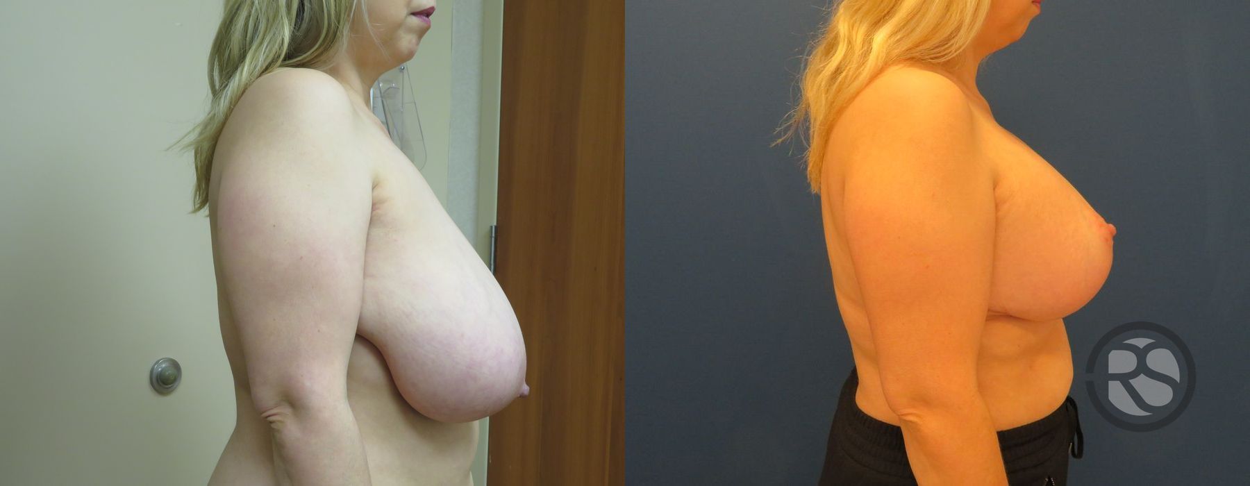 Before photo - Angle 3