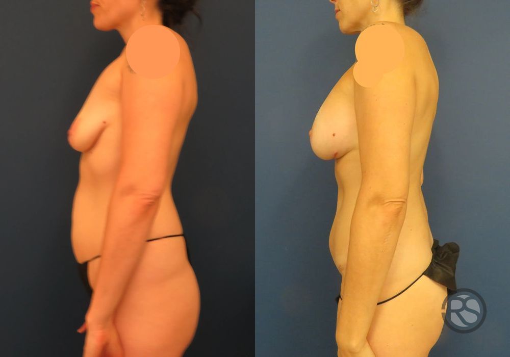 Before photo - Angle 5