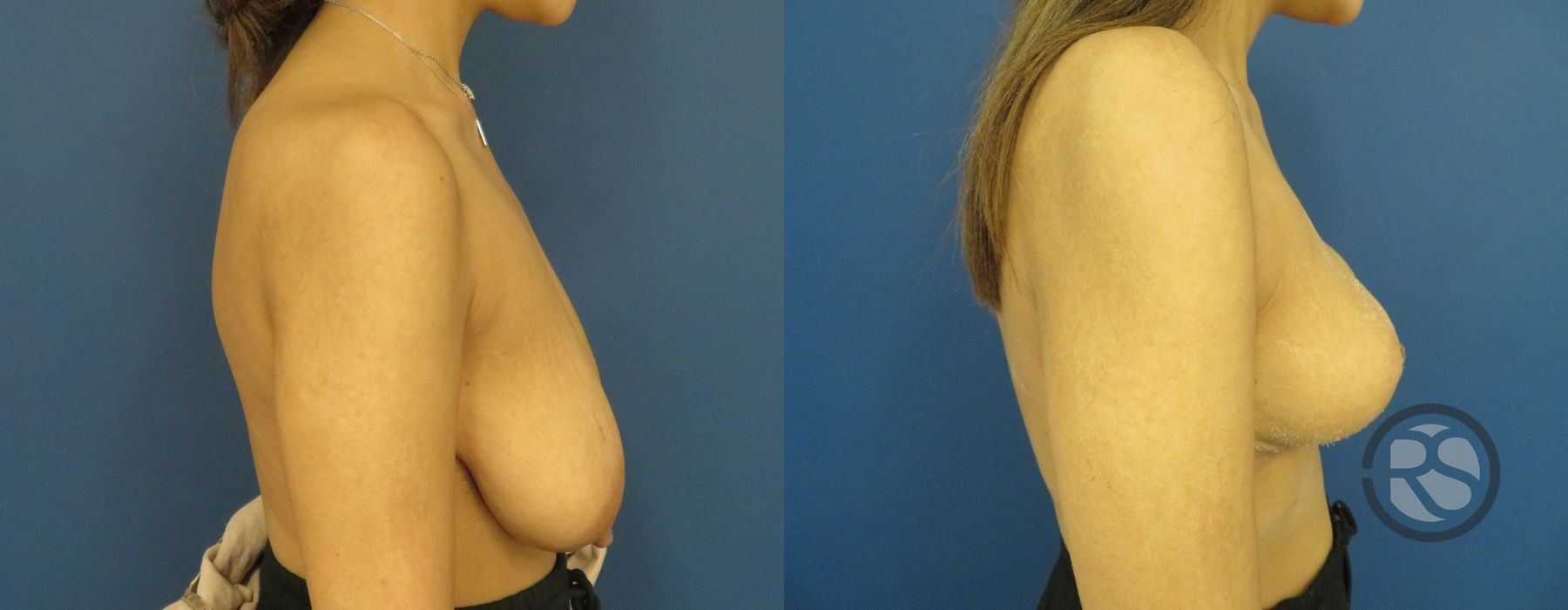 Before photo - Angle 3