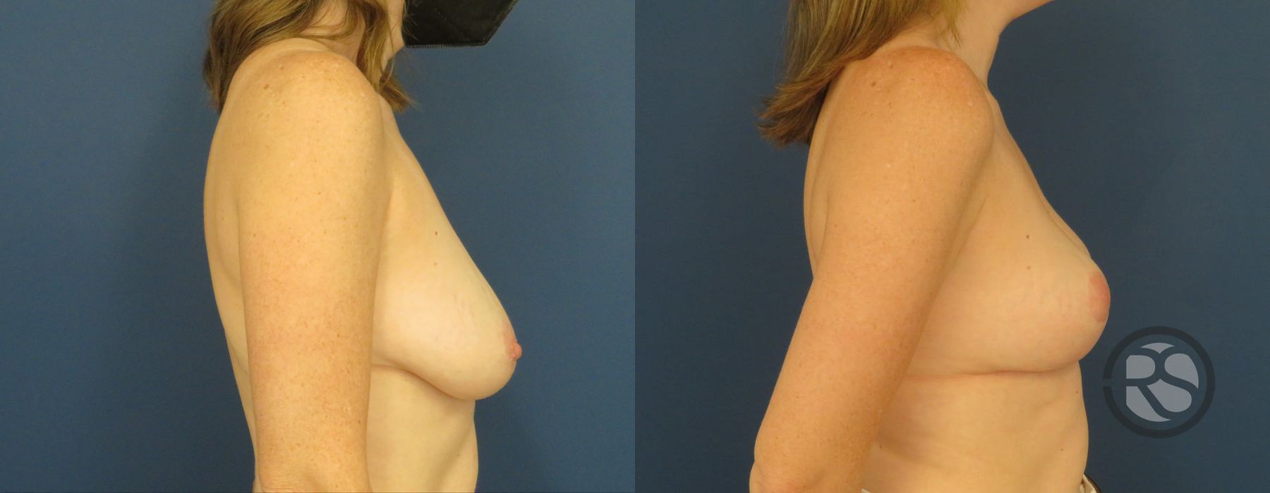 Before photo - Angle 3