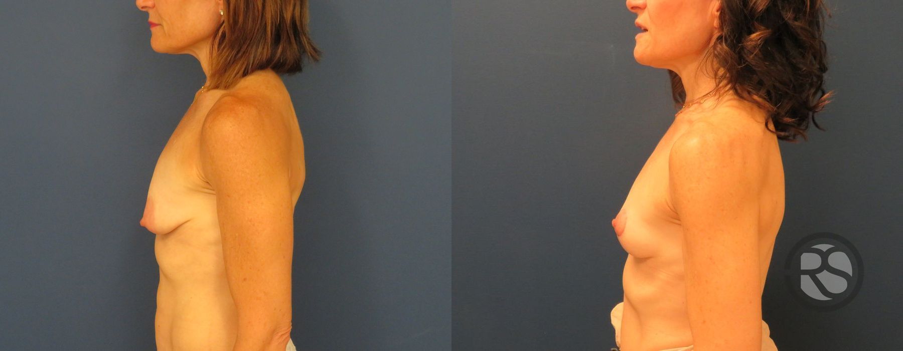 Before photo - Angle 5