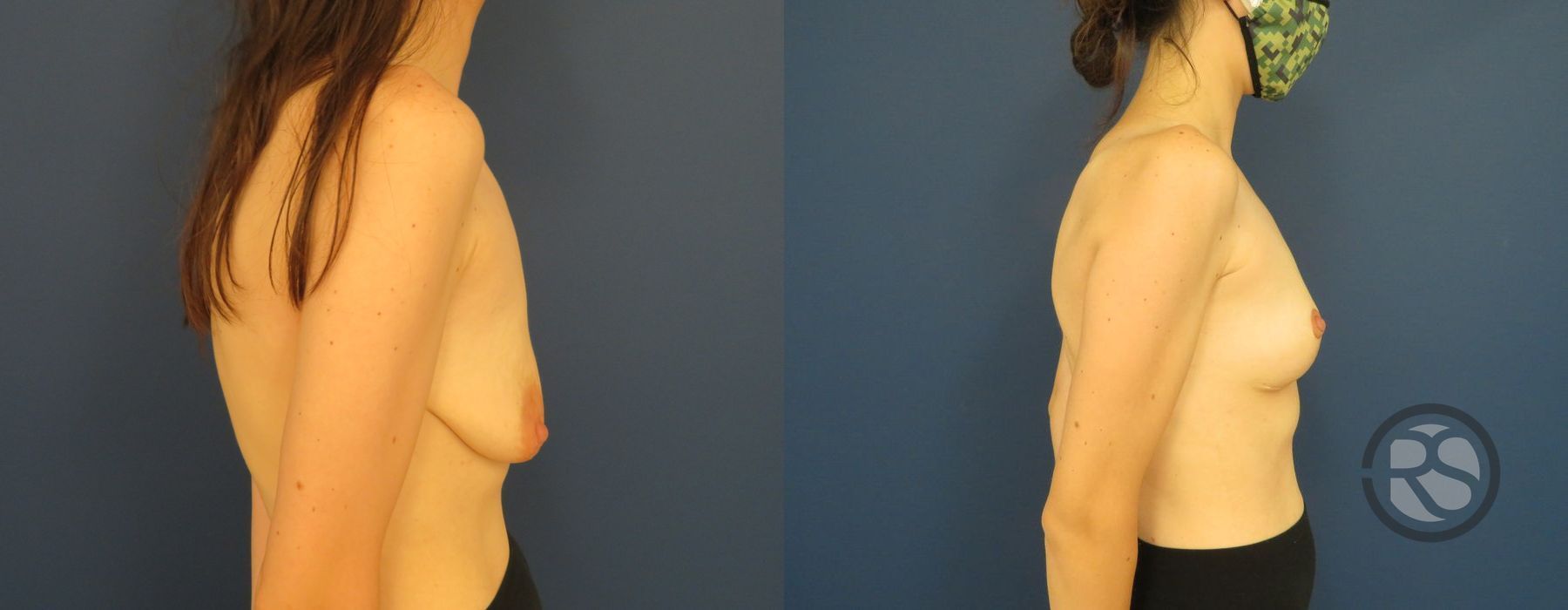 Before photo - Angle 3