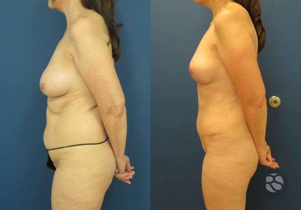 Before photo - Angle 5