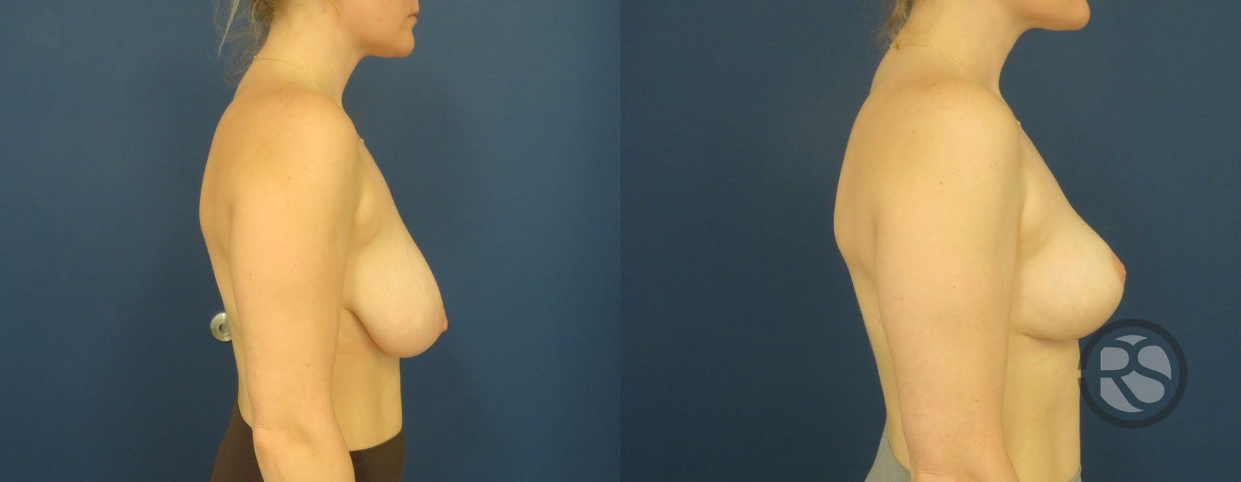 Before photo - Angle 3