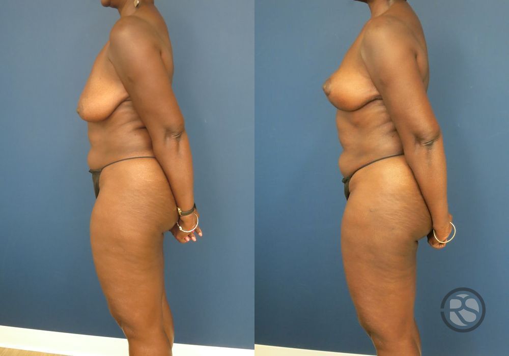 Before photo - Angle 5