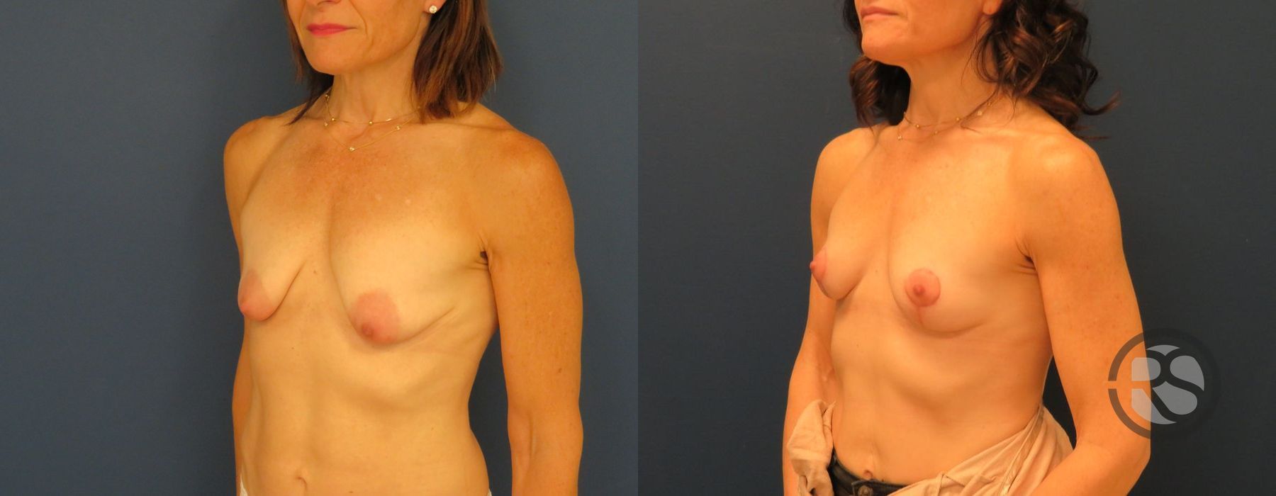 Before photo - Angle 4