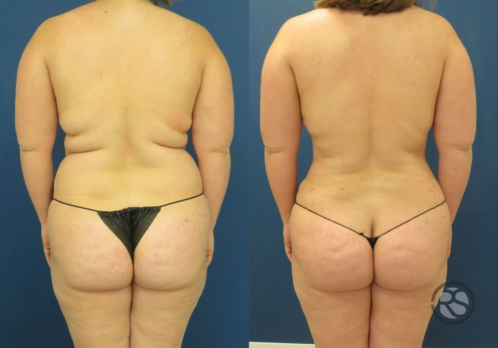 Before photo - Angle 6