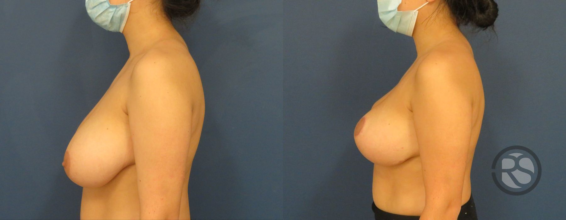 Before photo - Angle 5