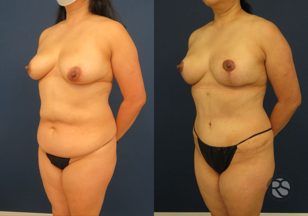 Before photo - Angle 4