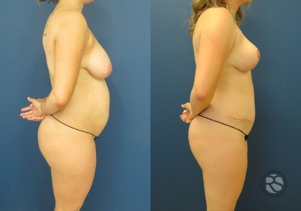 Before photo - Angle 3