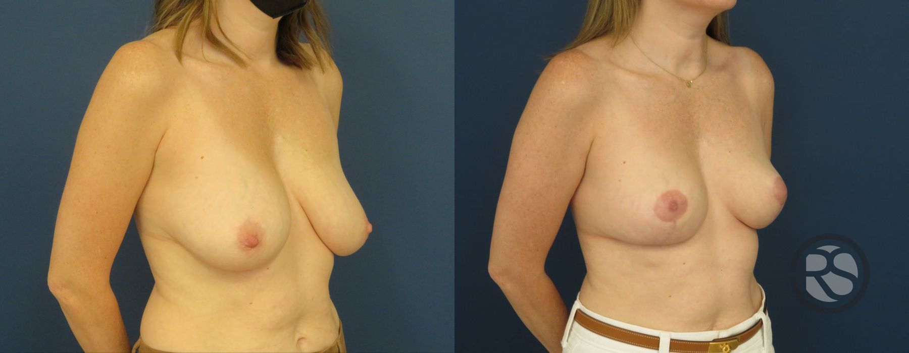 Before photo - Angle 2