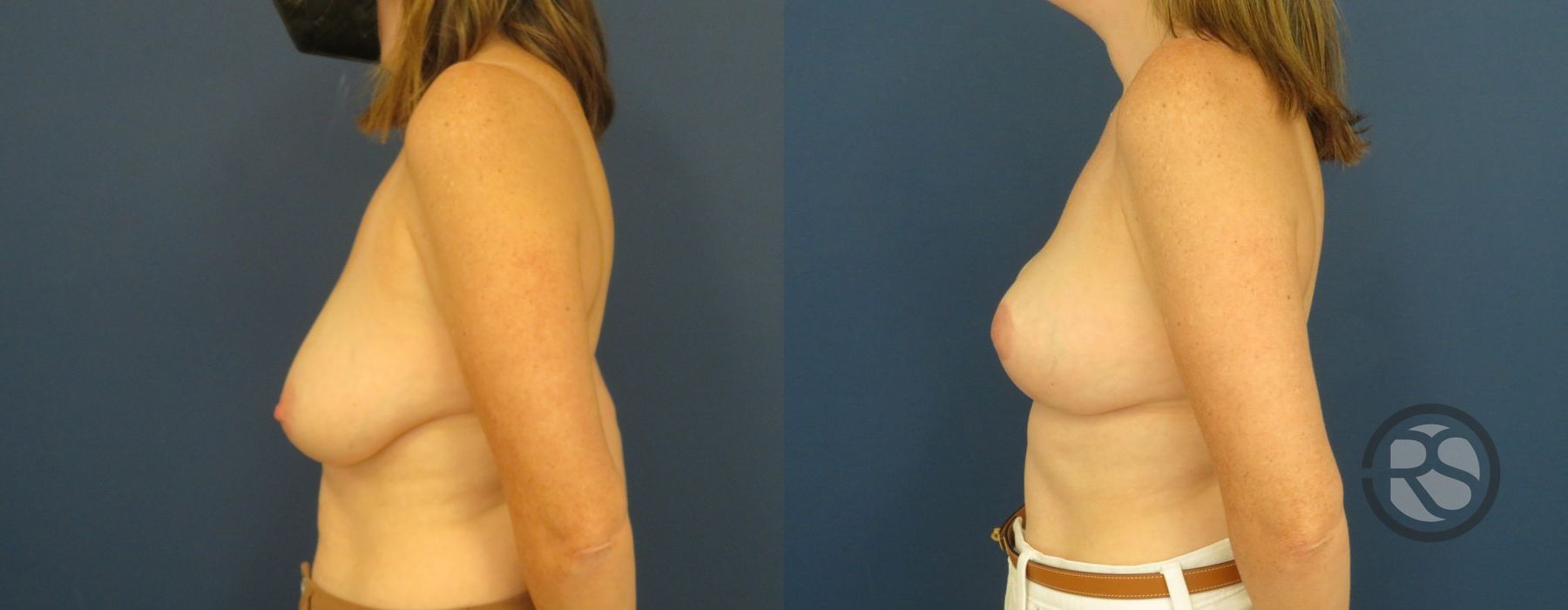 Before photo - Angle 5