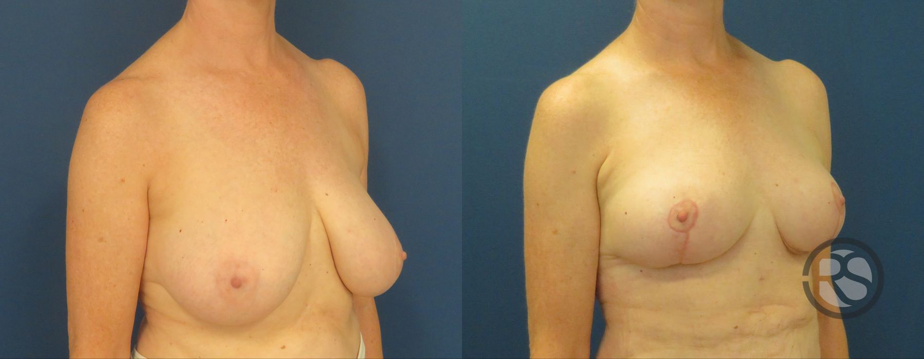 Before photo - Angle 2