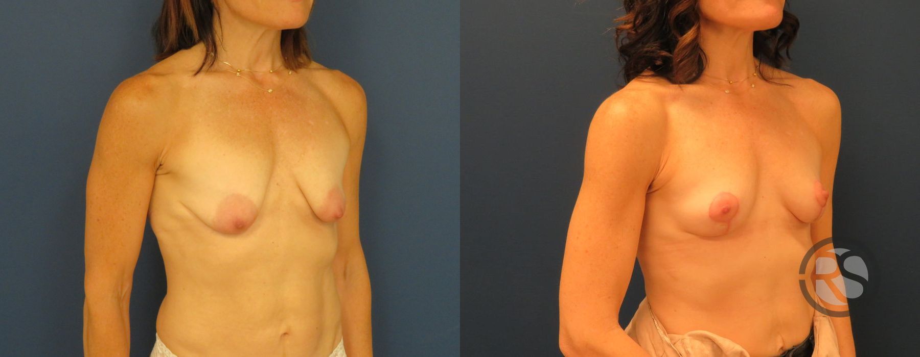 Before photo - Angle 2