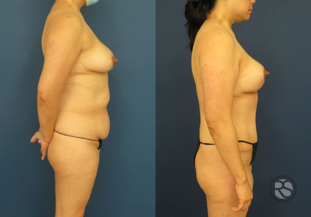 Before photo - Angle 3