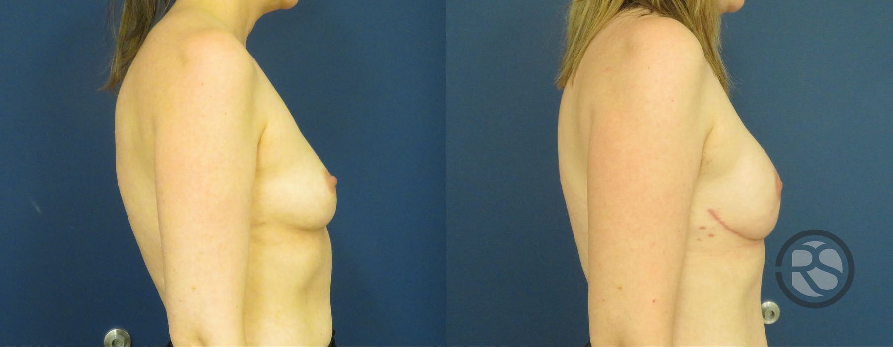 Before photo - Angle 3