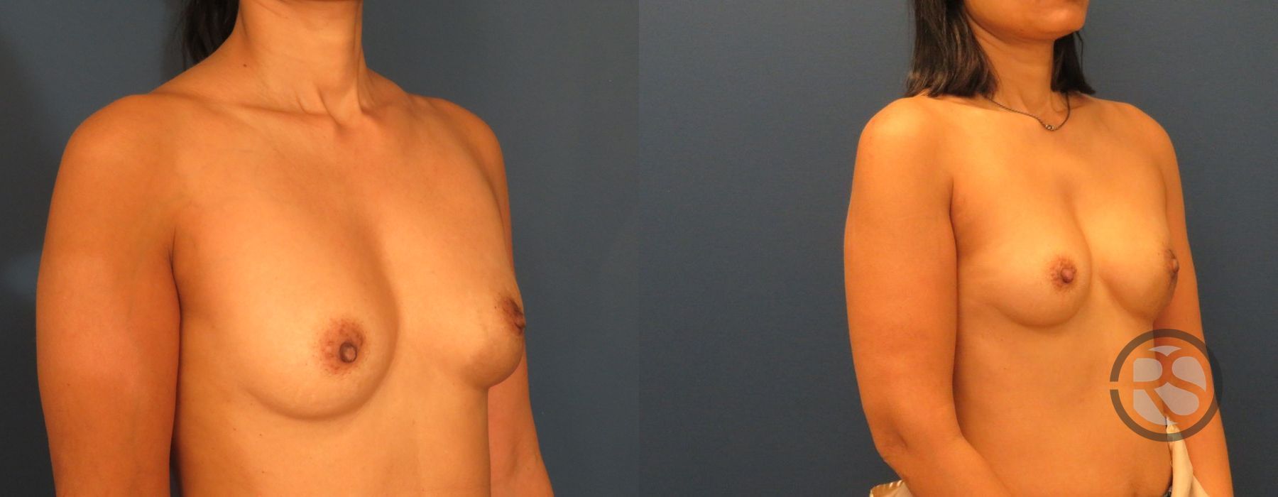 Before photo - Angle 2