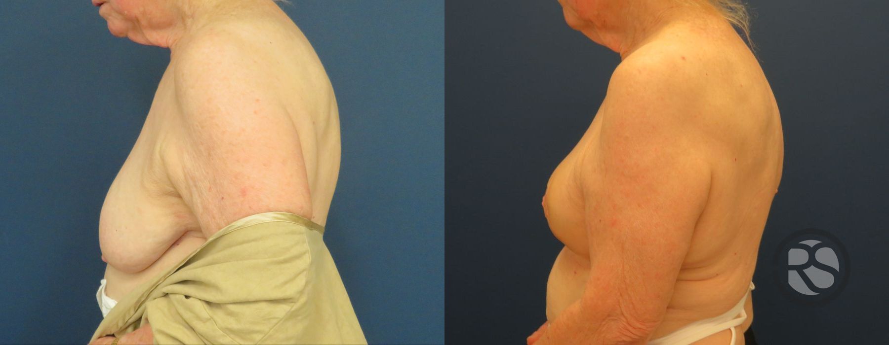 Before photo - Angle 5