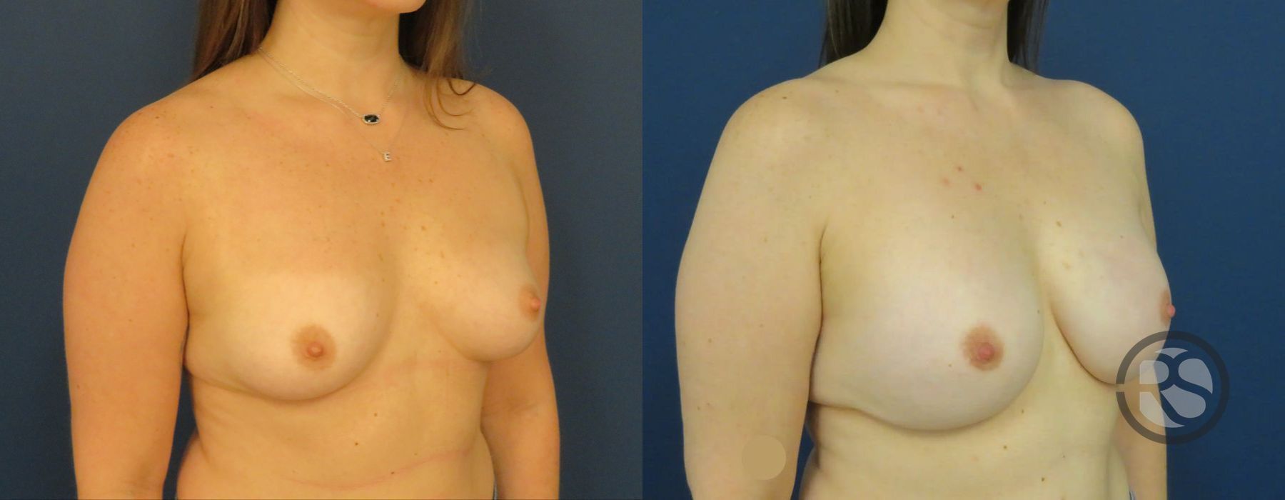 Before photo - Angle 2