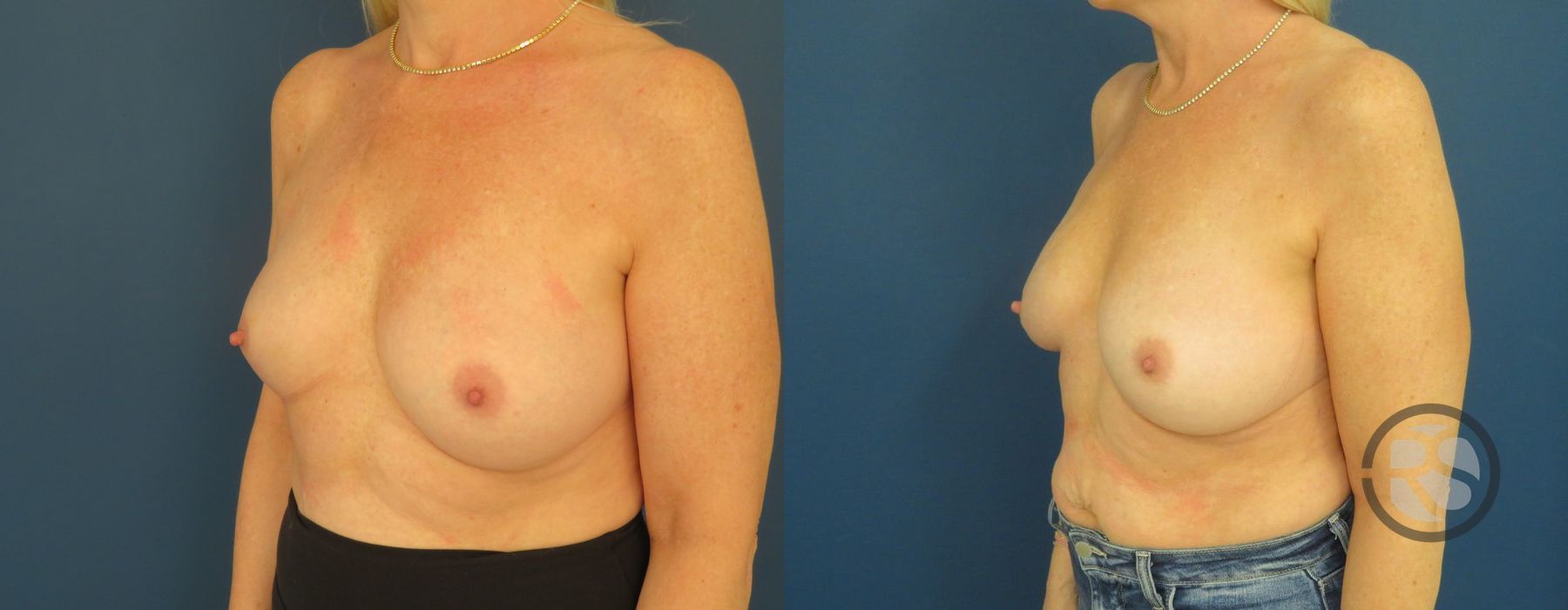 Before photo - Angle 4