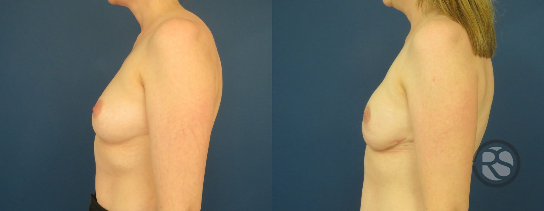 Before photo - Angle 5