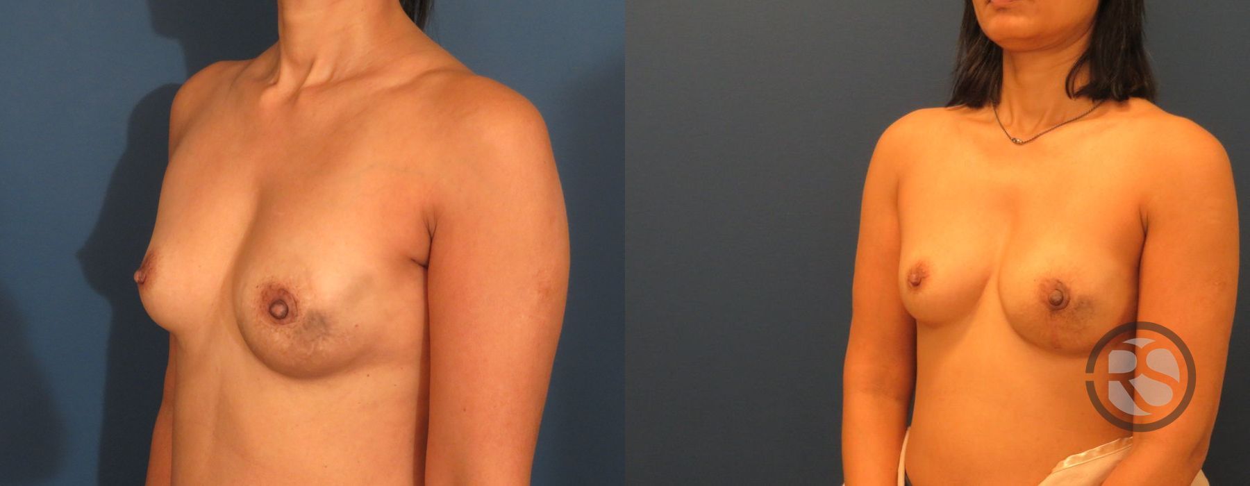 Before photo - Angle 4