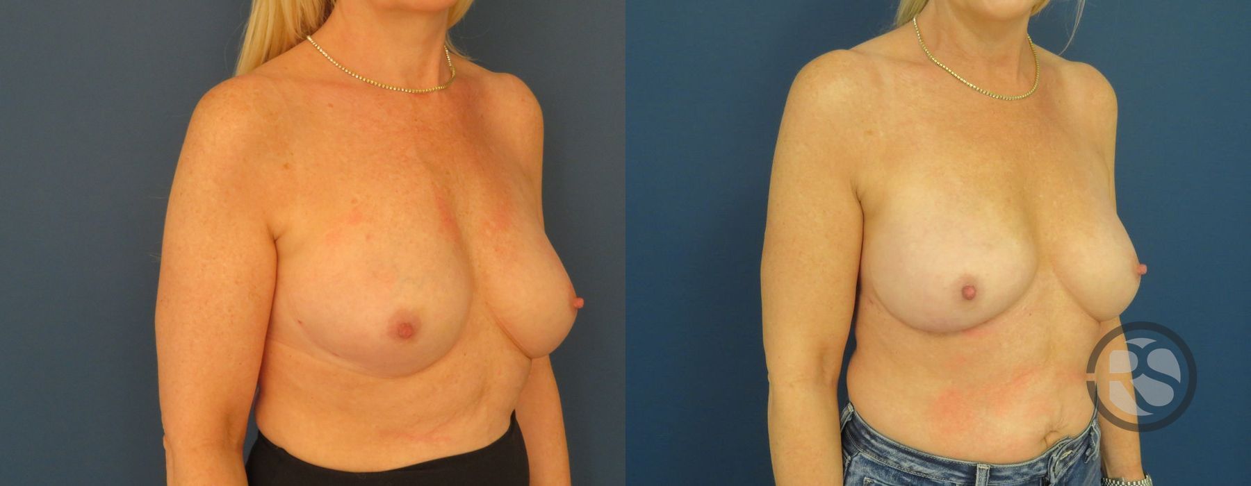 Before photo - Angle 2