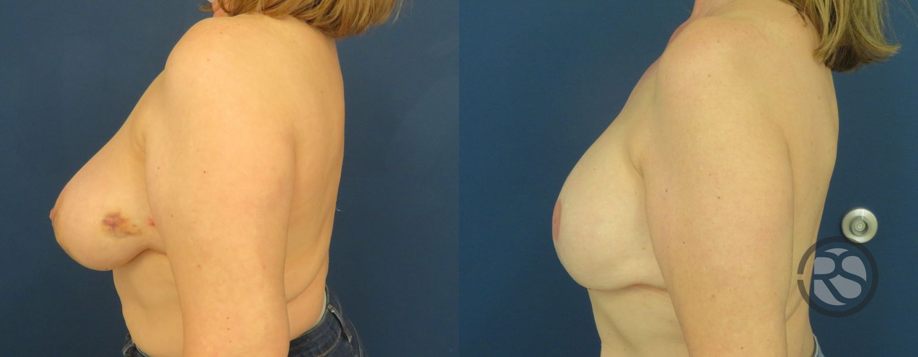 Before photo - Angle 5