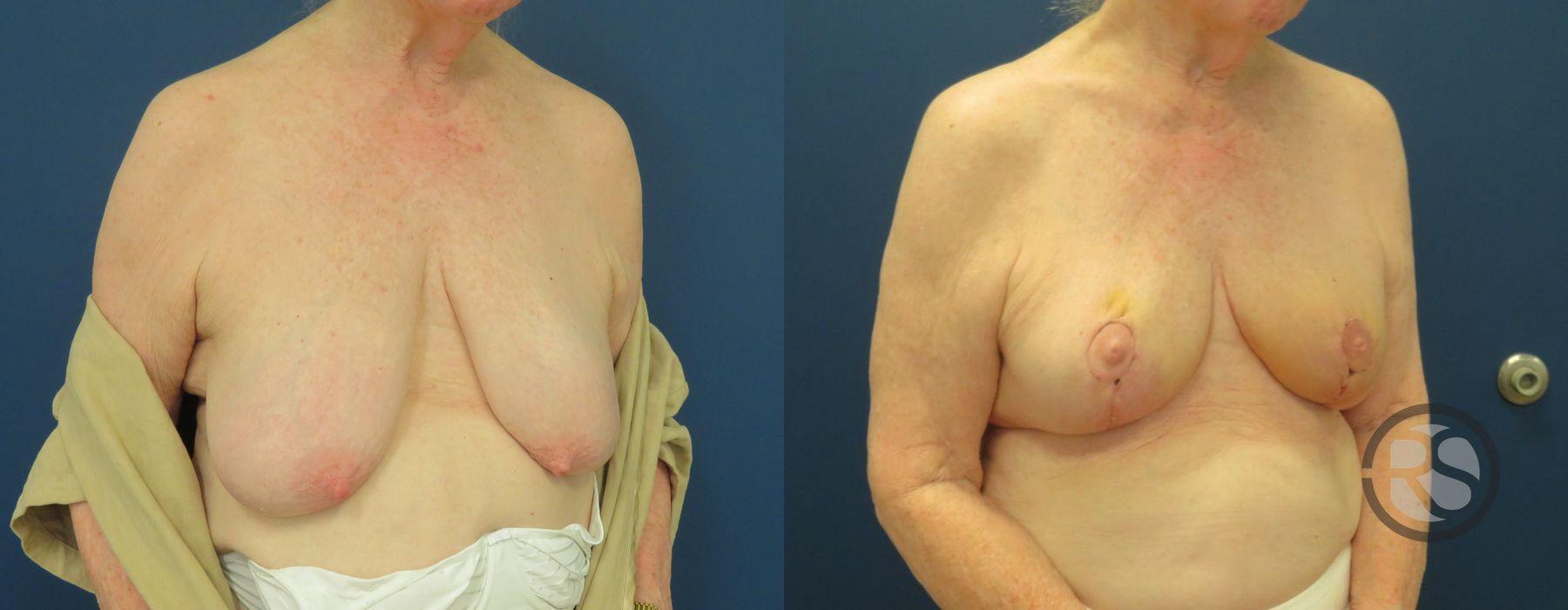 Before photo - Angle 2