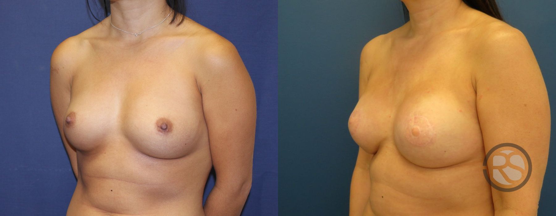 Before photo - Angle 4