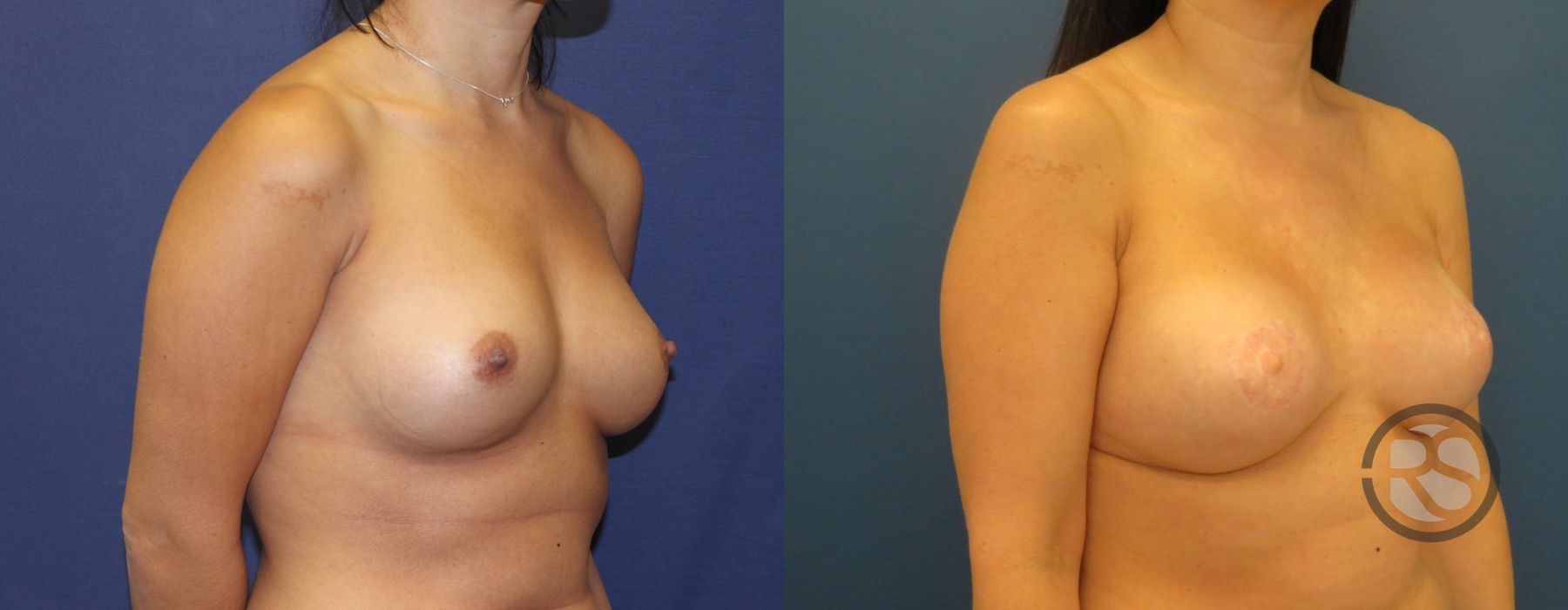 Before photo - Angle 2