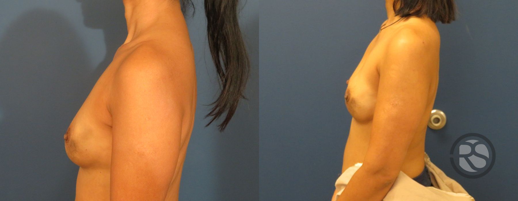 Before photo - Angle 5