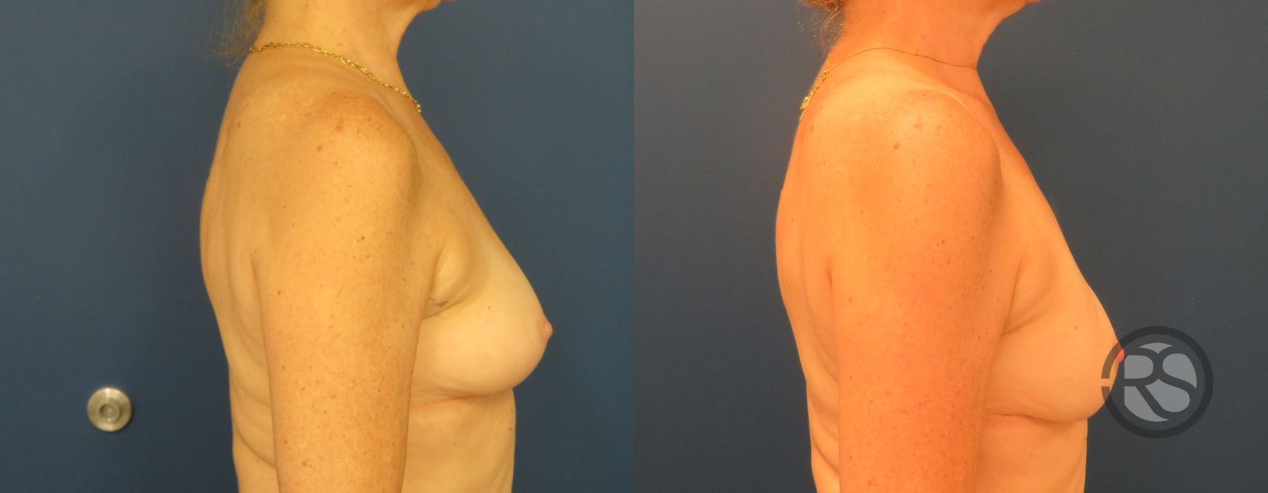 Before photo - Angle 3