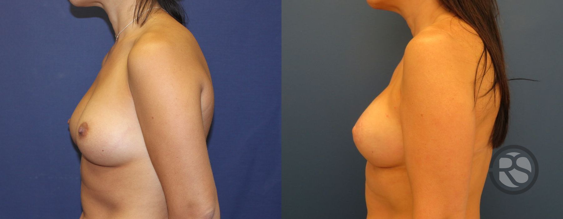 Before photo - Angle 5