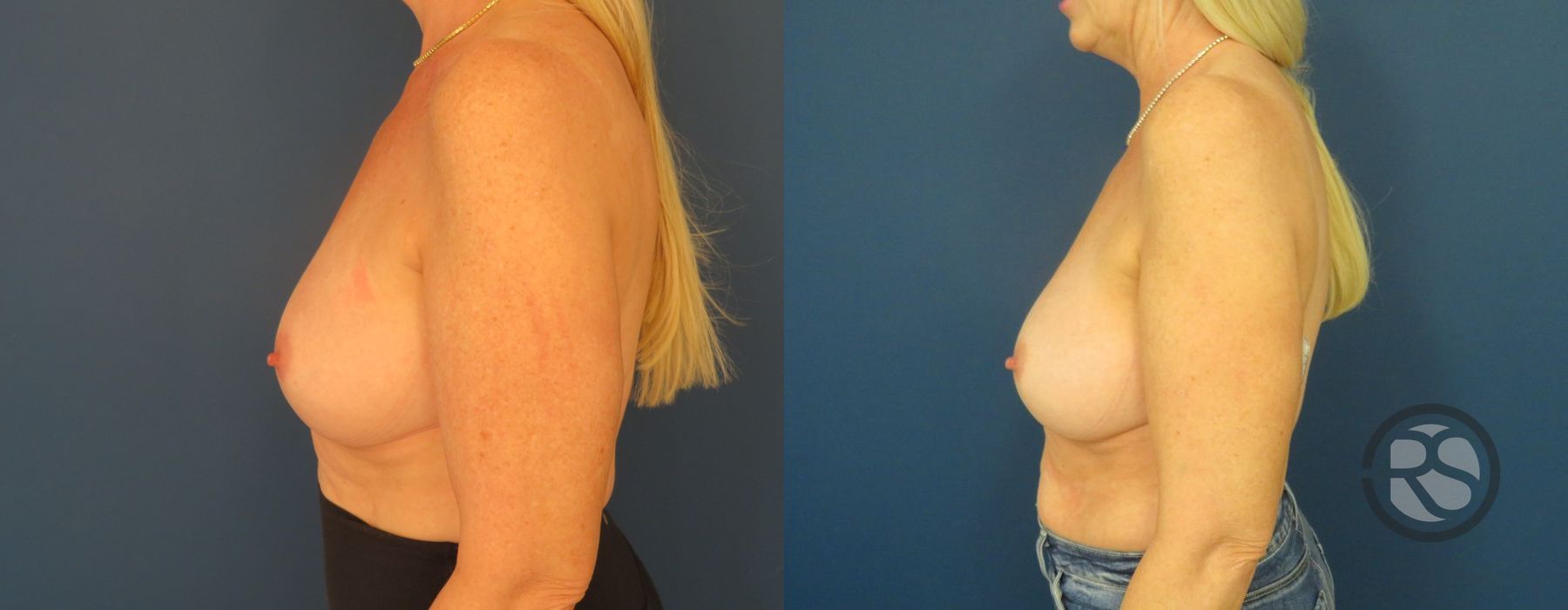 Before photo - Angle 5