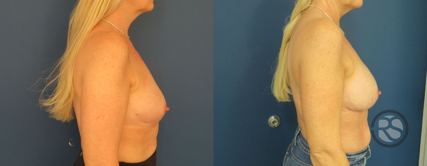 Before photo - Angle 3