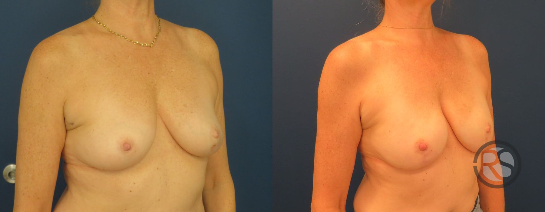 Before photo - Angle 2