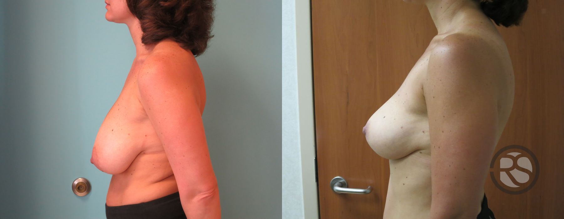 Before photo - Angle 5